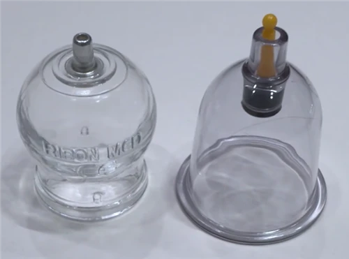 Das Vergleichsvideo von Schröpfen aus Glas und Schröpfen aus Kunststoff, das ...